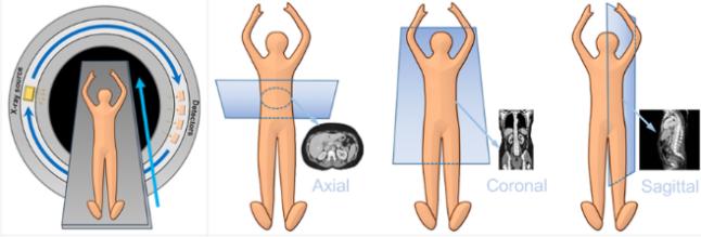 At present, the incidence and fatality rate of lung cancer in China rank first among all malignant tumors. Despite the contin