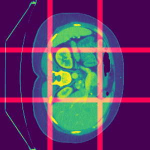 Standard modern machine-learning-based imaging methods have faced challenges in medical applications due to the high cost of