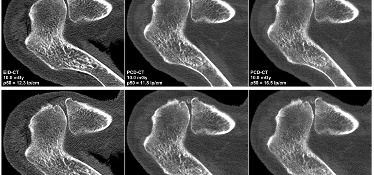 Medical imaging faces challenges such as limited spatial resolution, interference from electronic noise and poor contrast-to-