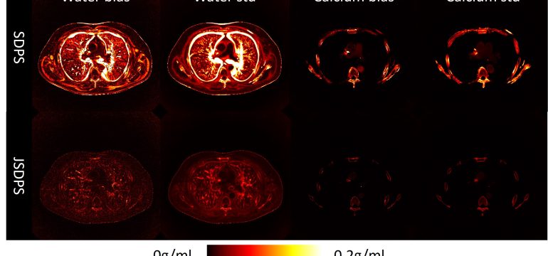 In this work, we introduce a new deep learning approach based on diffusion posterior sampling (DPS) to perform material decom