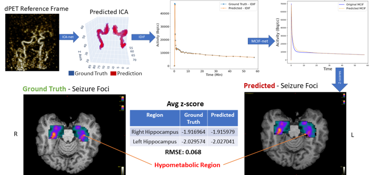 Dynamic 2-[18F] fluoro-2-deoxy-D-glucose positron emission tomography (dFDG-PET) for human brain imaging has considerable cli