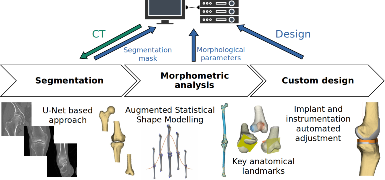 Arthroplasty is commonly performed to treat joint osteoarthritis, reducing pain and improving mobility. While arthroplasty ha