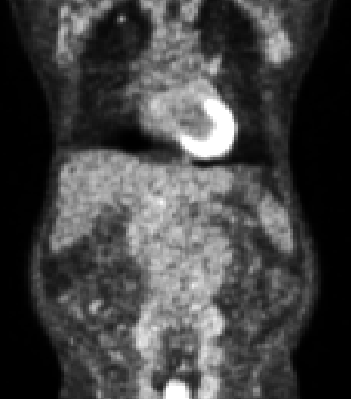 Automated slice classification is clinically relevant since it can be incorporated into medical image segmentation workflows