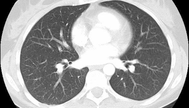 Manual diagnosis and analysis of COVID-19 through the examination of lung Computed Tomography (CT) scan images by physicians