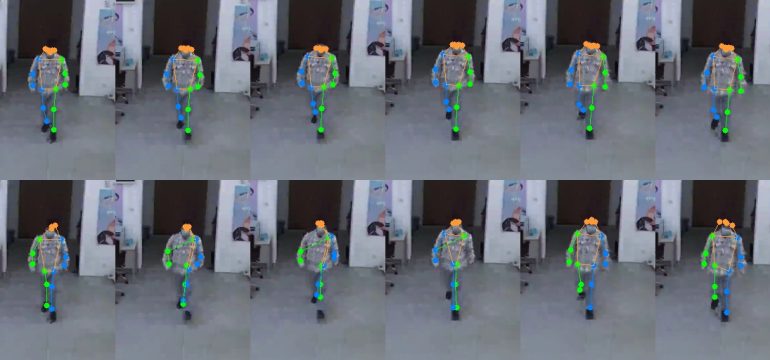 Surveillance footage represents a valuable resource and opportunities for conducting gait analysis. However, the typical low