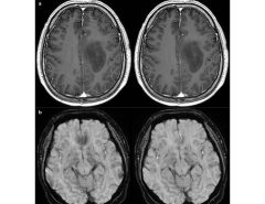 We introduce a novel, all-in-one deep learning framework for MR image reconstruction, enabling a single model to enhance imag