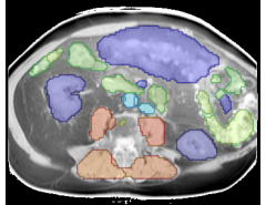 Purpose: To introduce a deep learning model capable of multi-organ segmentation in MRI scans, offering a solution to the curr