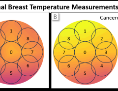 The pursuit of enhanced breast cancer detection and monitoring techniques is a paramount healthcare objective, driving the ne